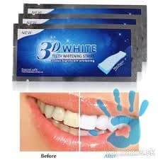 bielice-pasiky-na-zuby-znacky-3d-white-teeth-whitening-strips