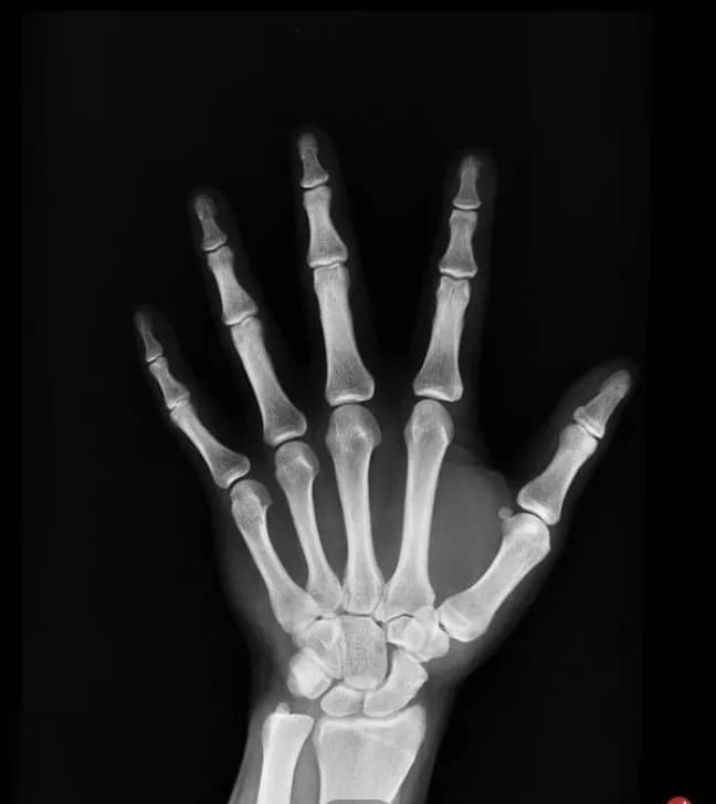 rontgenove-filmy-a-priemyselna-radiografia